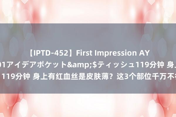 【IPTD-452】First Impression AYA</a>2009-05-01アイデアポケット&$ティッシュ119分钟 身上有红血丝是皮肤薄？这3个部位千万不行长，赶快对镜自查